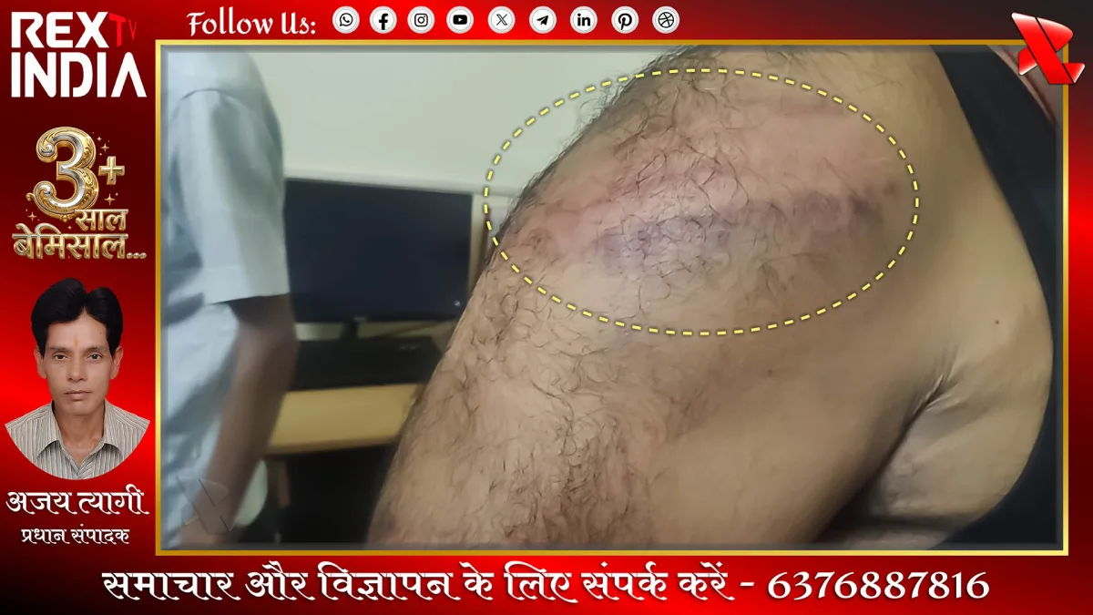जीआरपी जवानों के साथ मारपीट और बदमाशों का तांडव