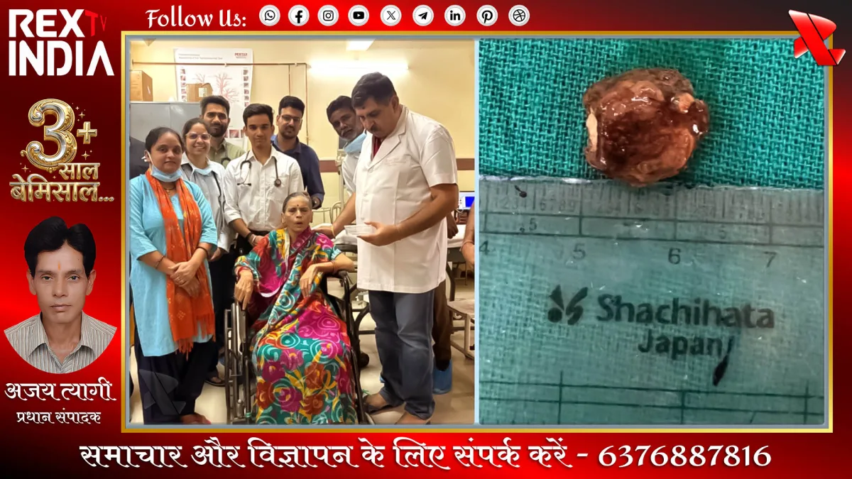 ईलाज करने वाली टीम और निकाली गई सुपारी