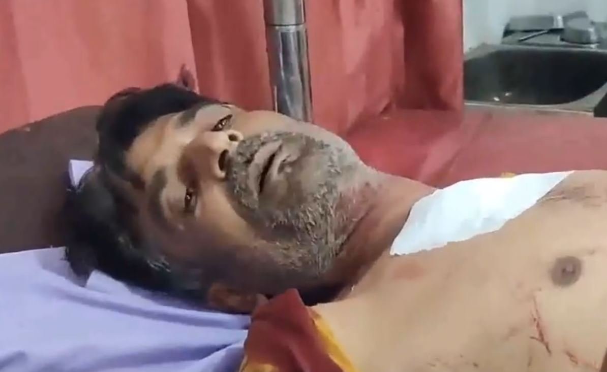 फायरिंग से भगदड़, सीने में लगी गोली: घायल युवक भीलवाड़ा रेफर, पुलिस की घेराबंदी
