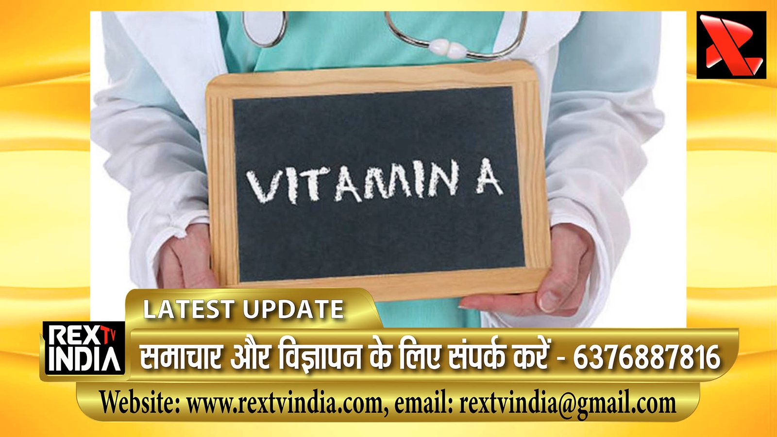कुपोषण पर वार: भीलवाड़ा में 9 माह से 5 वर्ष के बच्चों को पिलाई जाएगी विटामिन-ए की खुराक